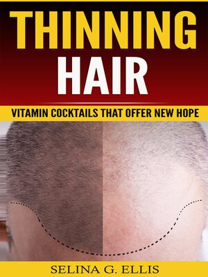 cover image of Thinning Hair